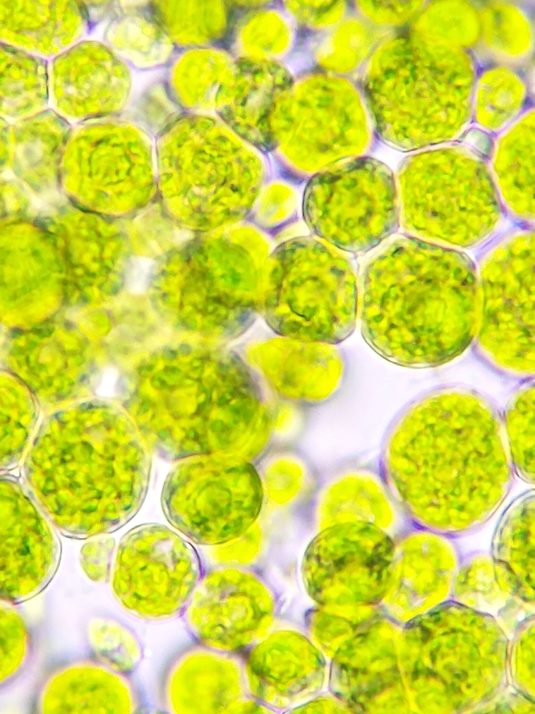 Algae Cells_vertica